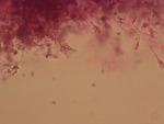 MISSING THUMBNAIL